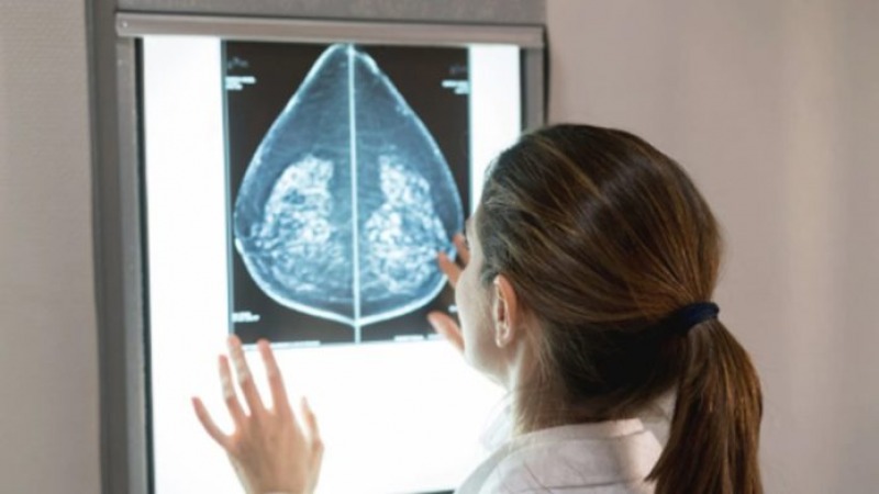 Cncer de mama: cada ao se diagnostican 21 mil nuevos casos