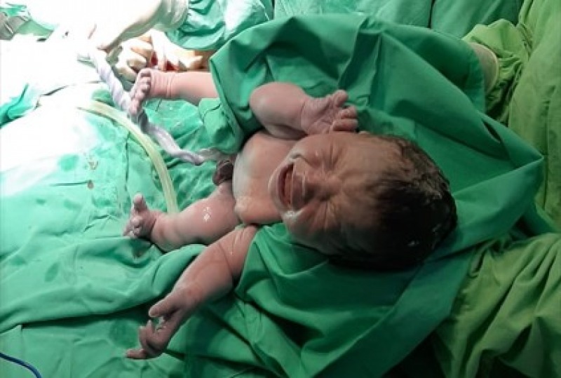 El 60% de los partos en el Hospital son por ces�rea