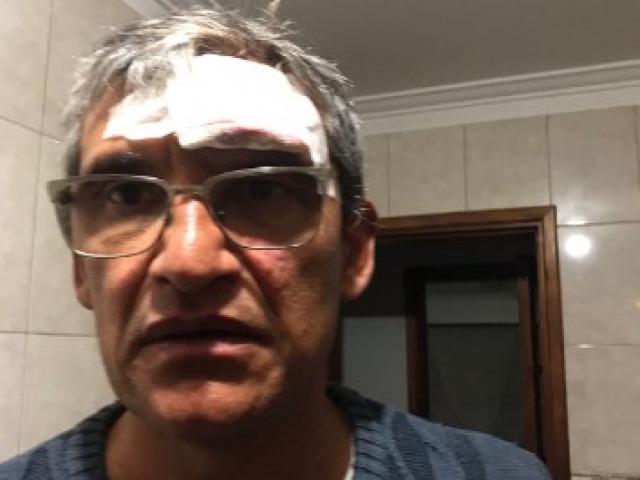 Leve sancin para los gravsimos incidentes en Chacarita de Azul