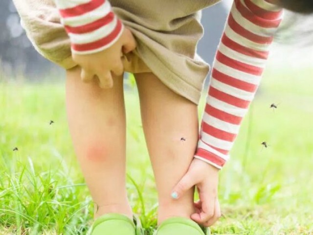 Dengue: cules son las medidas de prevencin en bebs y nios?