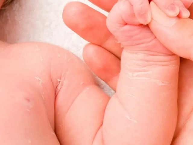 Temor por el impacto de despidos en el Programa de Cardiopat�as