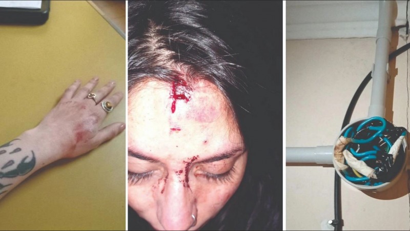 Pelea con heridos en el edificio de Dorrego y Moreno